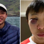 Joven asiático es brutalmente golpeado en Londres: "No quiero tu coronavirus en mi país"