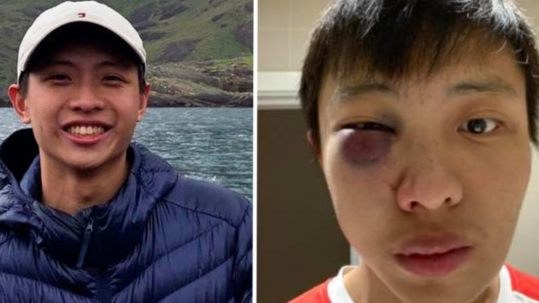Joven asiático es brutalmente golpeado en Londres: "No quiero tu coronavirus en mi país"