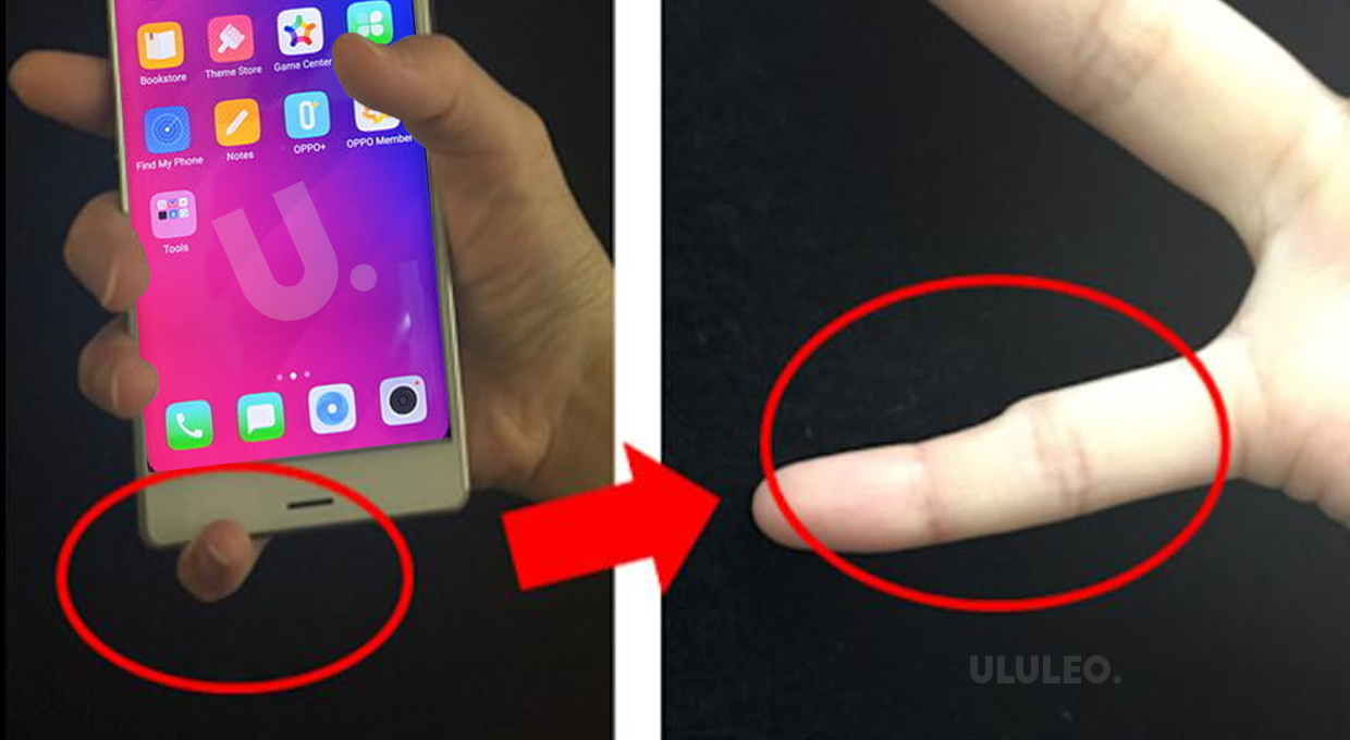 deformación en los dedos por el uso del movil