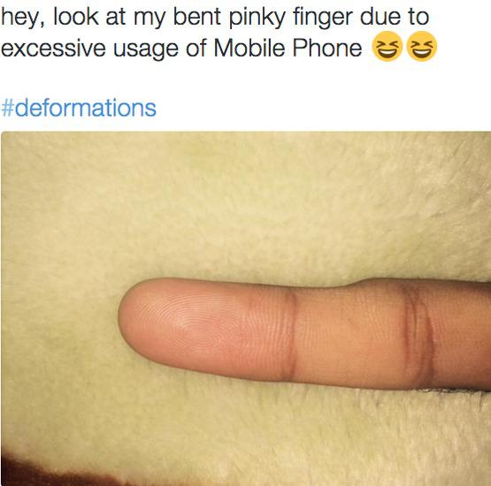 Usuarios de twitter reportaron que poseen la deformación