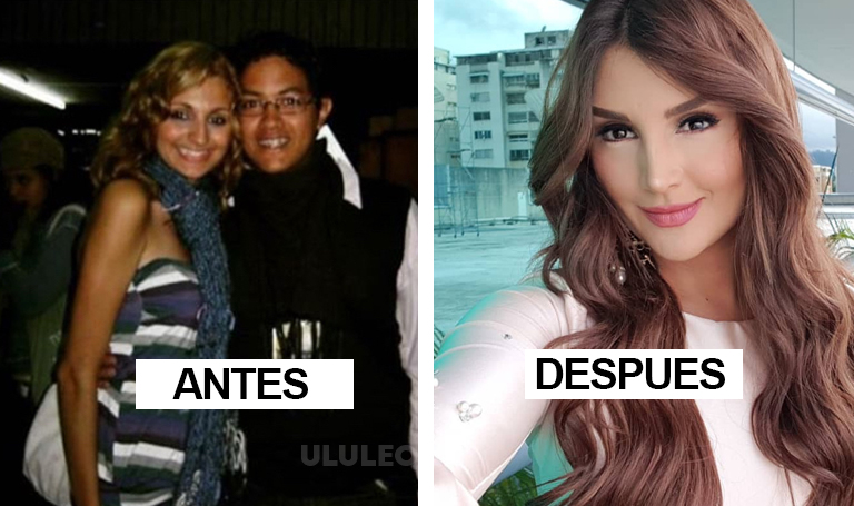 Antes y despues de Melany Mille