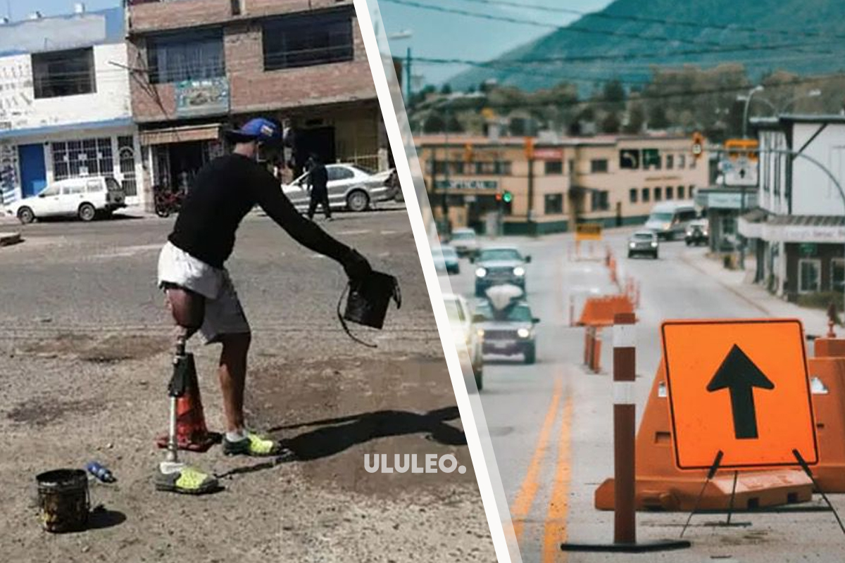 venezolano con pierna ortopédica en Perú